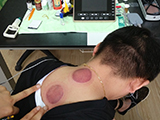 Bienestar empresarial: la ciencia médica tradicional china entra en la oficina